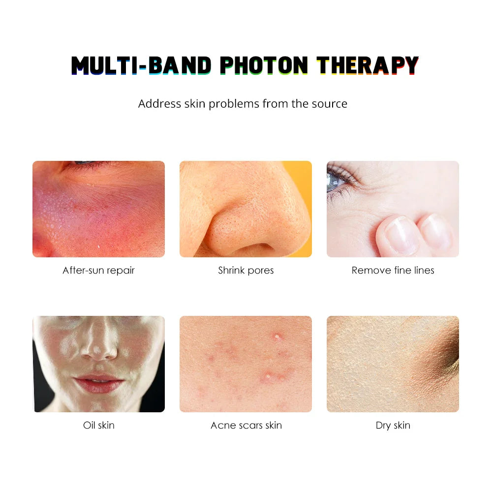 7 Color Phototherapy PDT LED Light Facials Machine Face Body Therapy Lamp