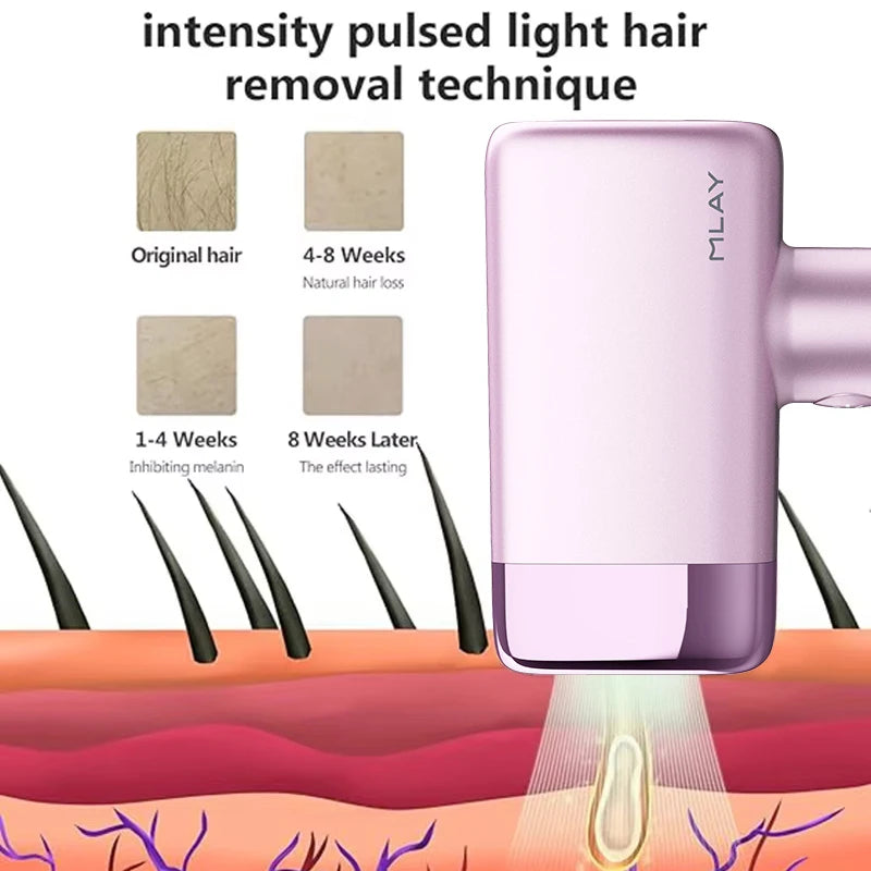 MLAY T14 IPL ICE Cooling IPL Laser Epilator Home Hair Removal Device Replaceable Face Body Bikini Lamps For Women Men Painless